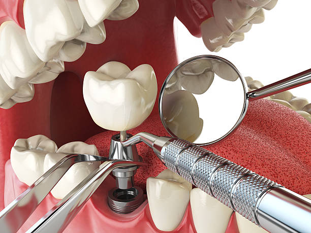 Best Emergency Dentist for Special Needs Patients in Rosemead, CA